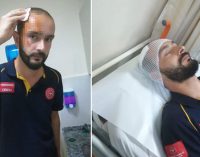 Sağlıkta şiddet: Ordu’da sağlık görevlisine perde demiriyle saldırı