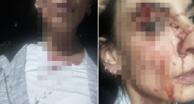 Oturdukları sitenin bahçesinde bira içen kadınlara saldırı: İki kişi tutuklandı