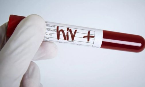 1 Aralık Dünya AIDS Günü’nde acı tablo: HIV görülme yaşı 15’e kadar indi