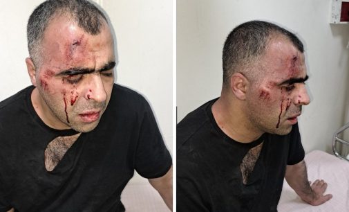 AKP’li belediye başkanının korumaları gazeteci dövdü: “Bir daha yazarsan geberirsin…”